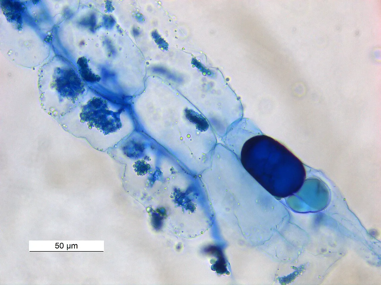 Vesicular arbuscular mycorrhizae in the terminal roots of Horse Gram plant
