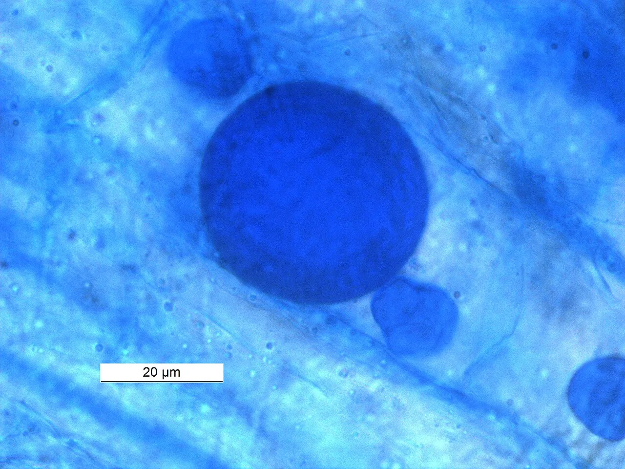 Bilayered glomoid spore of arbuscular mycorrhizal fungi in the root of Horse Gram