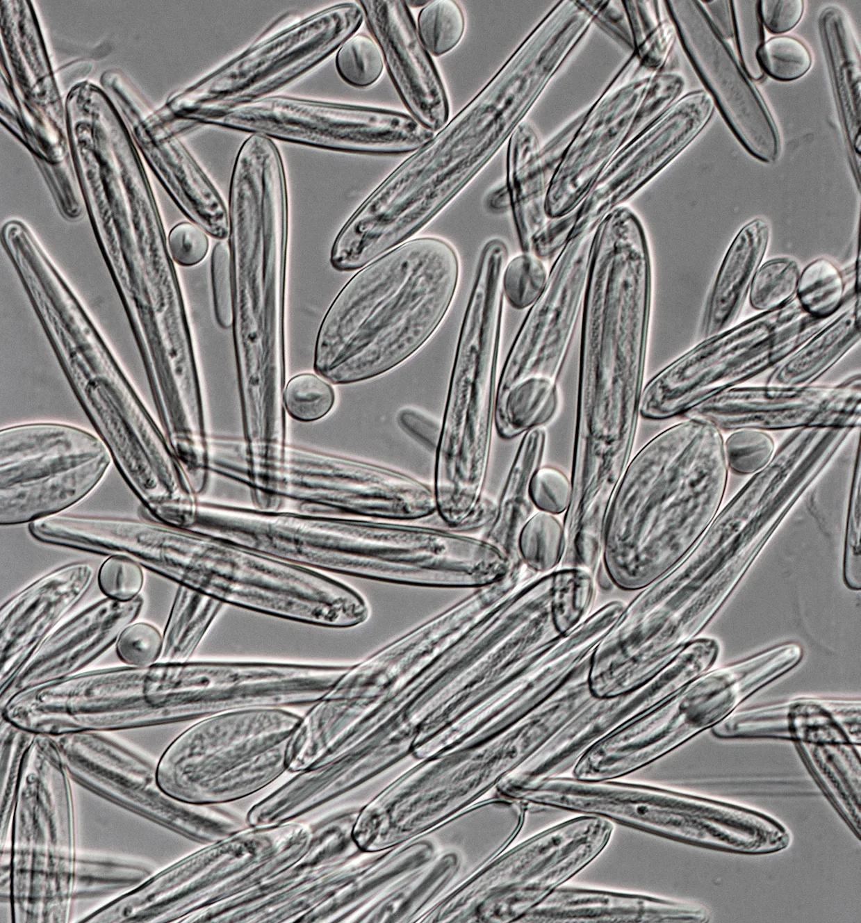 Cnidocytes from Chironex fleckeri (400x magnification)