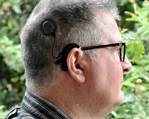 Cochlear implant recipient utilizing a behind-the-ear processor