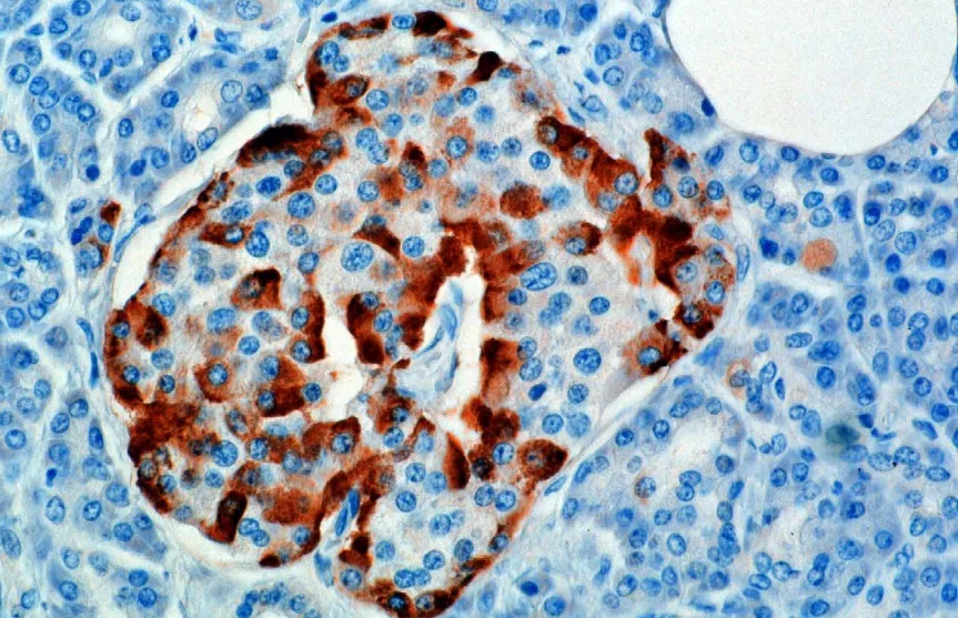 A microscopic image stained for glucagon