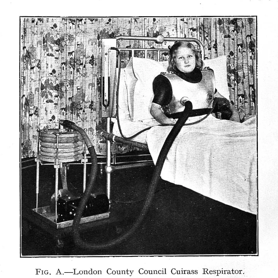 A patient wearing a cuirass respirator