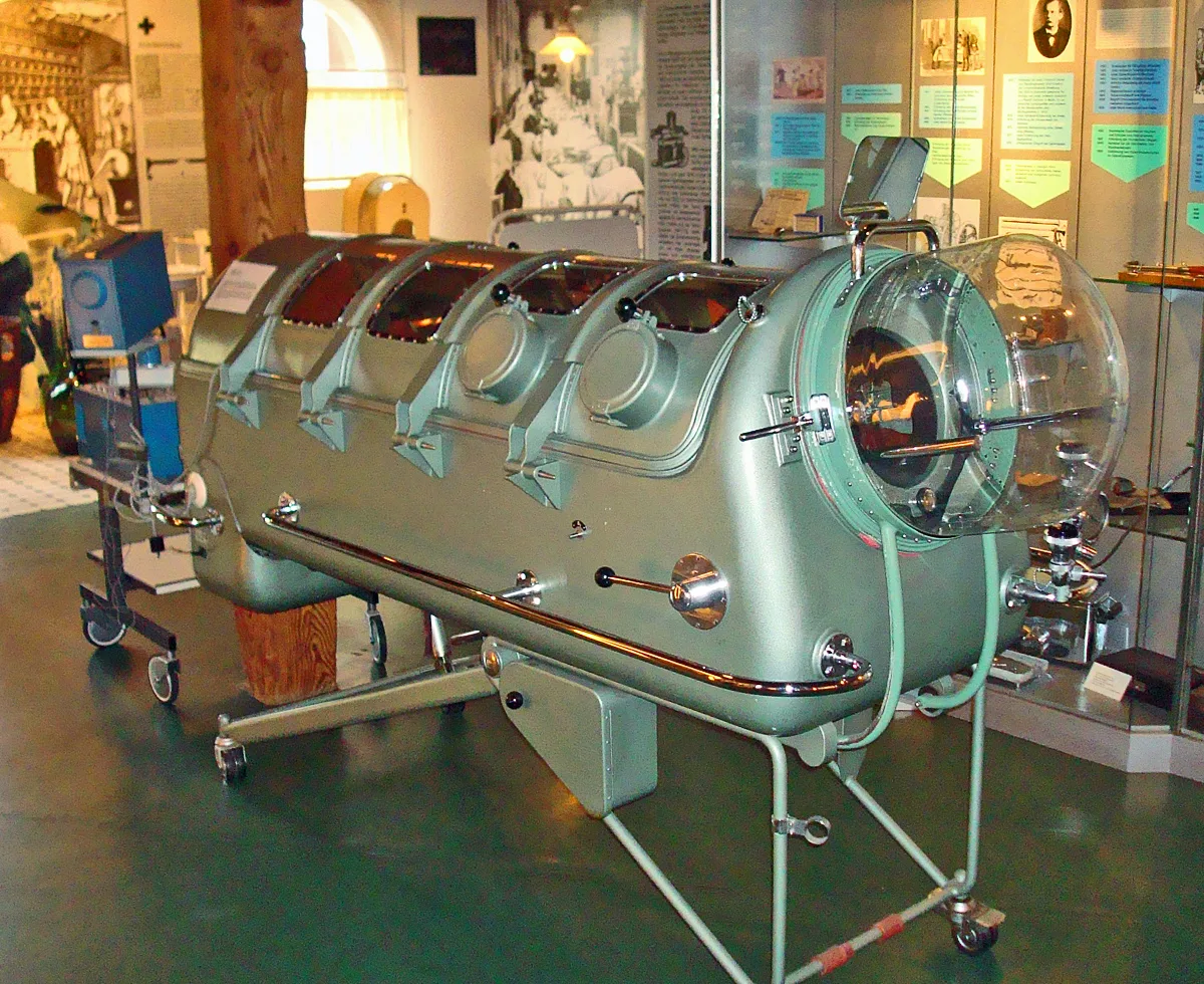 An iron lung from the 1950s in the Gütersloh Town Museum. In Germany, fewer than a dozen of these breathing machines are