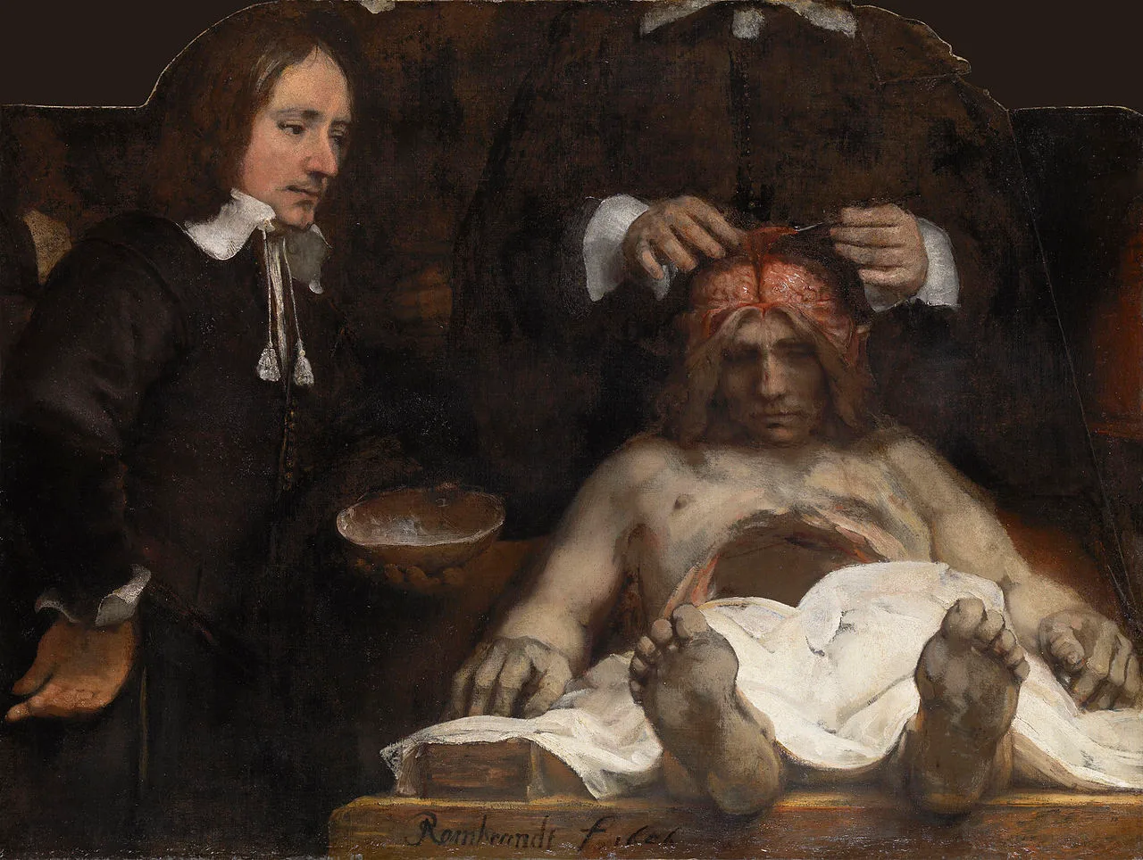 Rembrandt: The Anatomy Lesson of Dr. Deijman (1656)