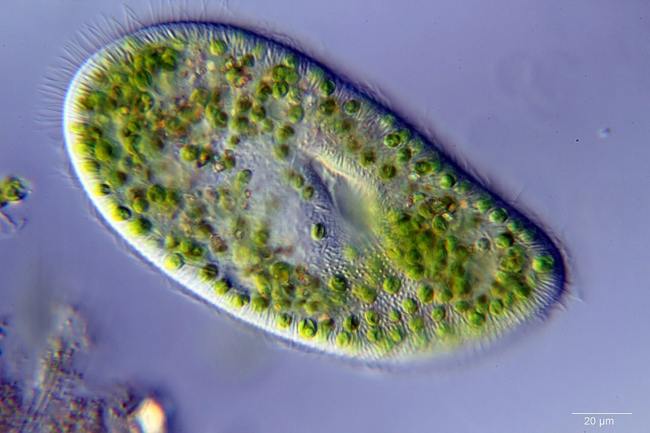 A ciliate with green zoochlorellae living inside it endosymbiotically